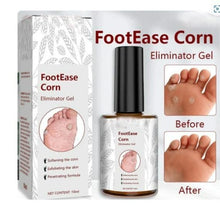 Load image into Gallery viewer, Feet Corn Removal Serum (Buy 1 Get 1 FREE) 🦶➡️😊