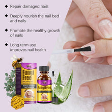 Load image into Gallery viewer, Fungi Free Bee Venom Nail Serum( Buy 1 Get 1 FREE! )⏰ Don't Miss Out!😍