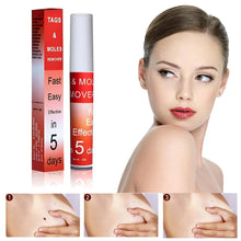 Load image into Gallery viewer, Buy 1 Get 1 FREE 🎁✨Tags & Moles Remover,! ✨