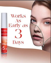 Load image into Gallery viewer, Buy 1   Get 1 FREE 🎁✨Tags &amp; Moles Remover,! ✨
