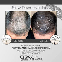 Load image into Gallery viewer, Ecoerty SheddStop Pro-Strength Hair Spray 100ml Pack of 1
