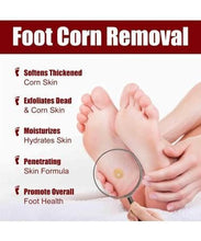 Load image into Gallery viewer, Feet Corn Removal Serum (Buy 1 Get 1 FREE) 🦶➡️😊
