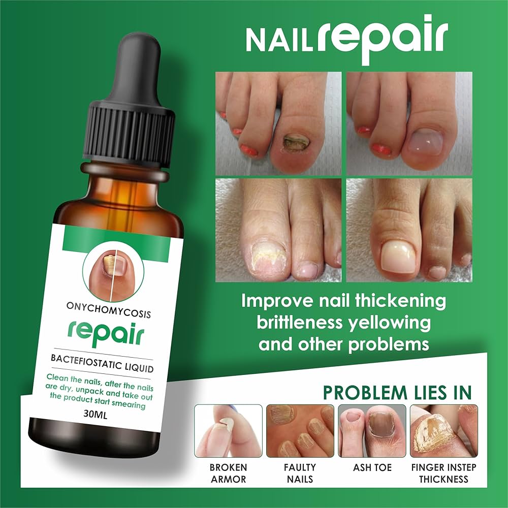🛍️🛒Buy 1 Get 1 Free: Nail Growth & Repair Oil Twin Pack!🛍️🛒