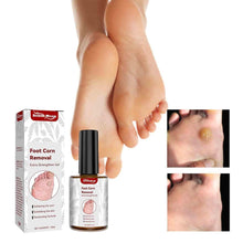 Load image into Gallery viewer, Feet Corn Removal Serum (Buy 1 Get 1 FREE) 🦶➡️😊
