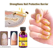 Load image into Gallery viewer, Fungi Free Bee Venom Nail Serum( Buy 1 Get 1 FREE! )⏰ Don&#39;t Miss Out!😍
