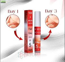 Load image into Gallery viewer, Buy 1   Get 1 FREE 🎁✨Tags &amp; Moles Remover,! ✨
